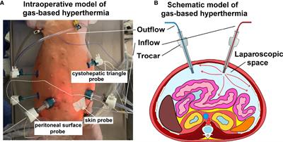 Safety, feasibility, and application of intraperitoneal gas-based hyperthermia beyond 43°C in the treatment of peritoneal metastasis: An in-vivo pilot study